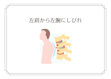 左肩から左腕にかけてのしびれ